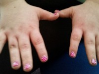 Spotty nails